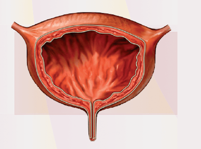 Signs -to cystitis