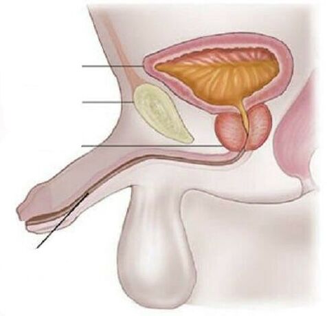 Cystitis on men
