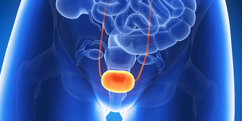 Treatment of inflammation of the bladder with tablets